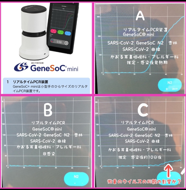 GeneSoC(R)mini
